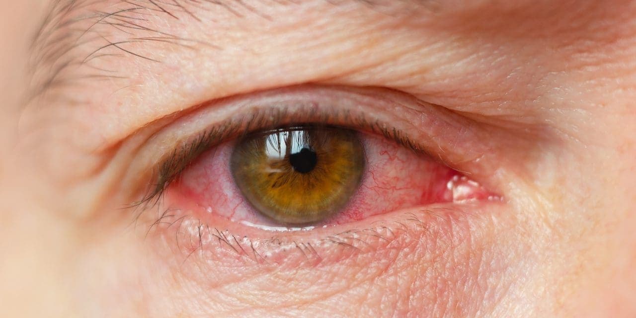 close-up of red eyes